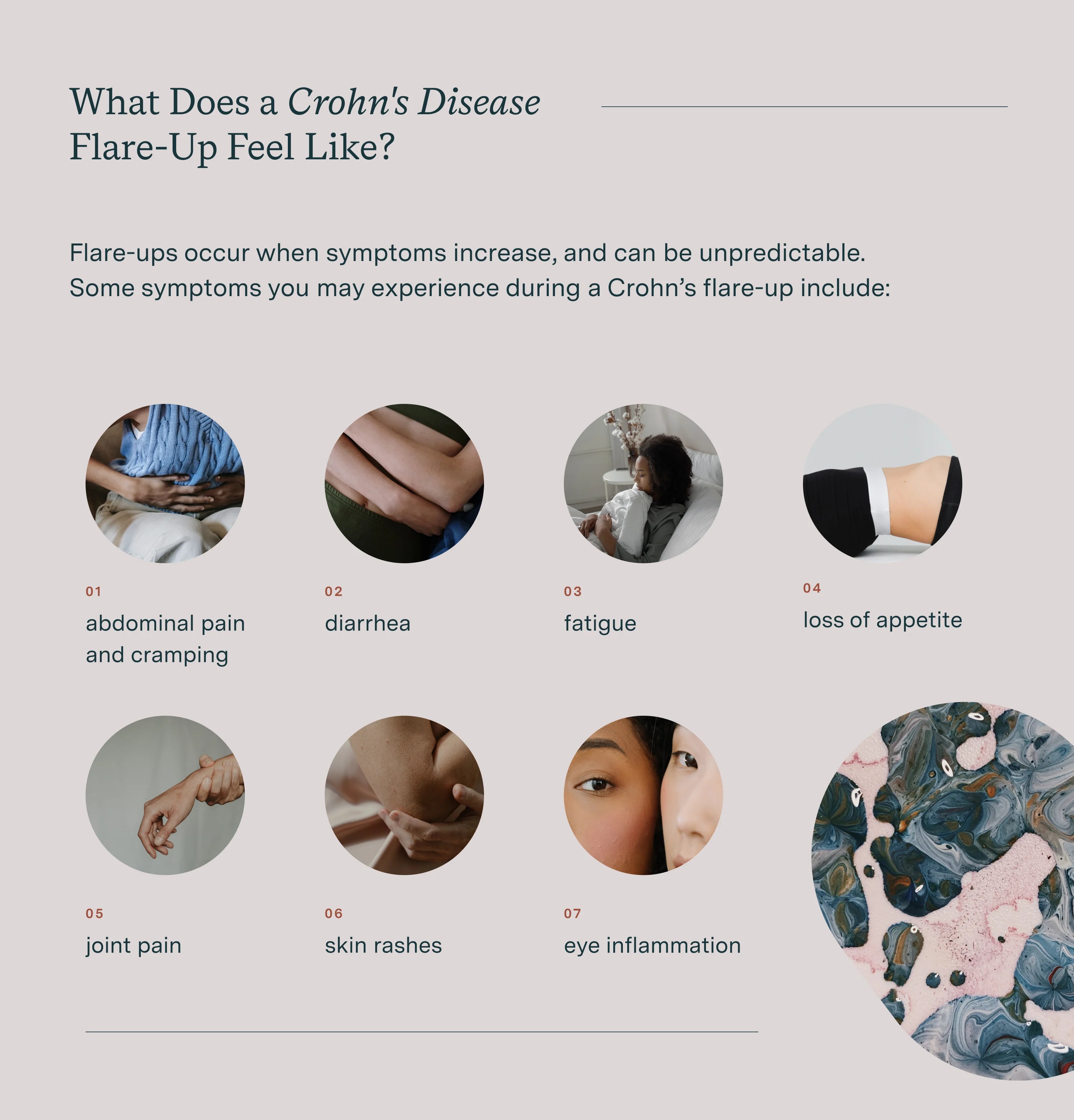 What Does a Crohn's Disease FlareUp Feel Like?